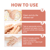 7 Day Nail Repair Essence Serum, Hand And Foot Nail Brightening Thickening Toenail Care Solution