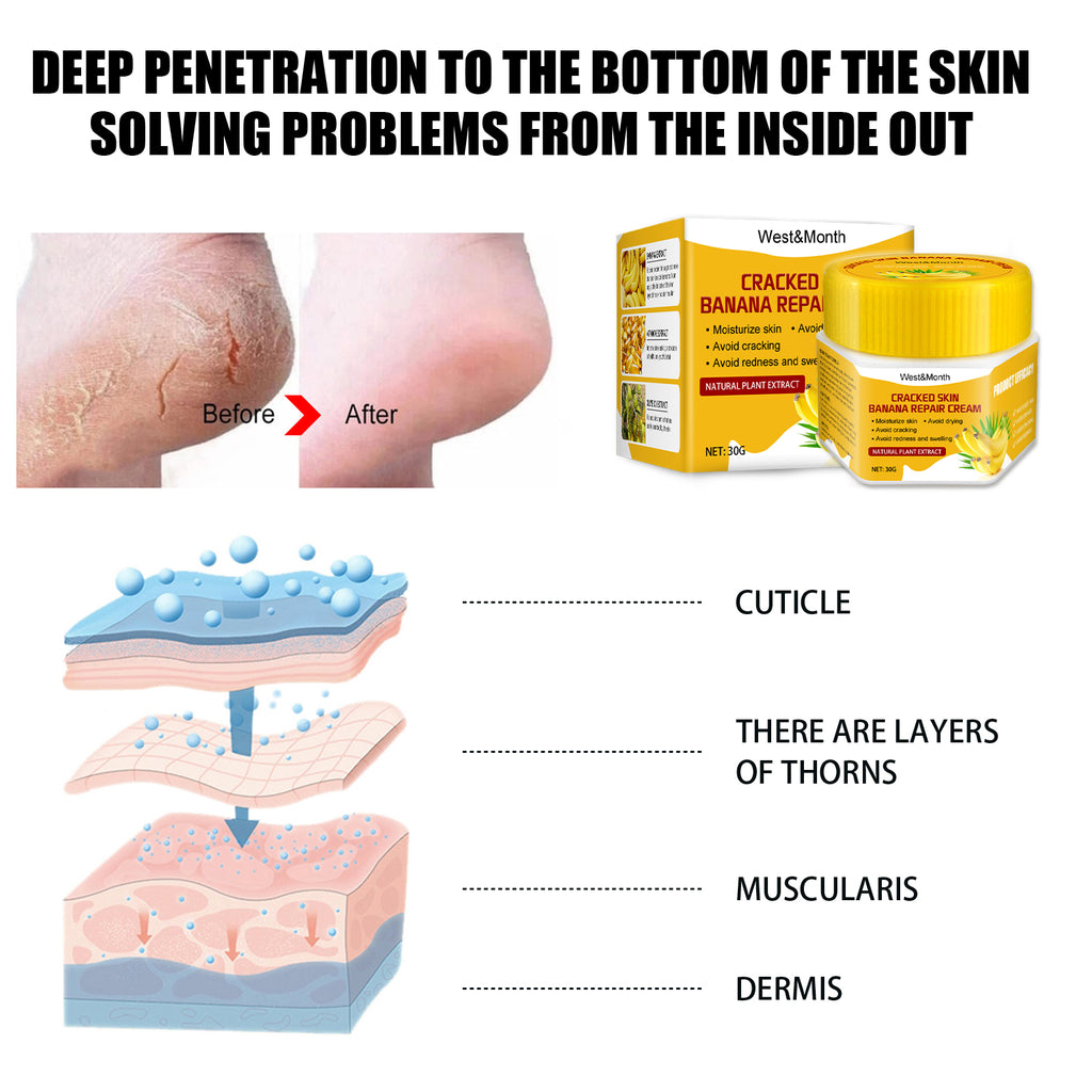 Cracked Skin Banana Foot Repair Cream, Nourishing And Moisturizing Foot Repair Cream