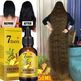 7 Day Fast Hair Growth Oil Ginger Growth Hair Treatment