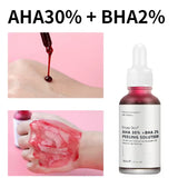 Natural Organic AHA 30% BHA 2% Serum Deep Peeling Exfoliating Solution Skin Facial Serum