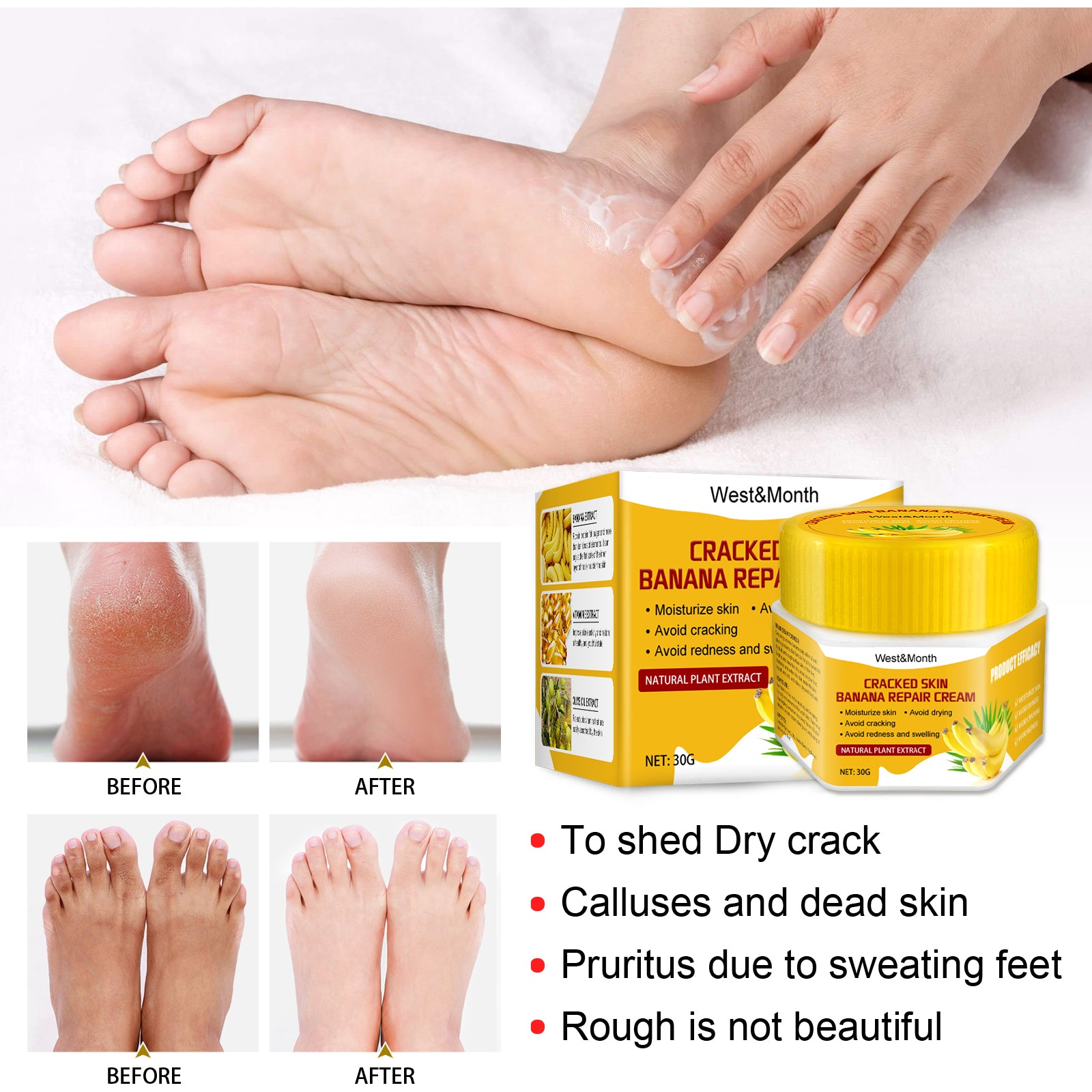 Cracked Skin Banana Foot Repair Cream, Nourishing And Moisturizing Foot Repair Cream