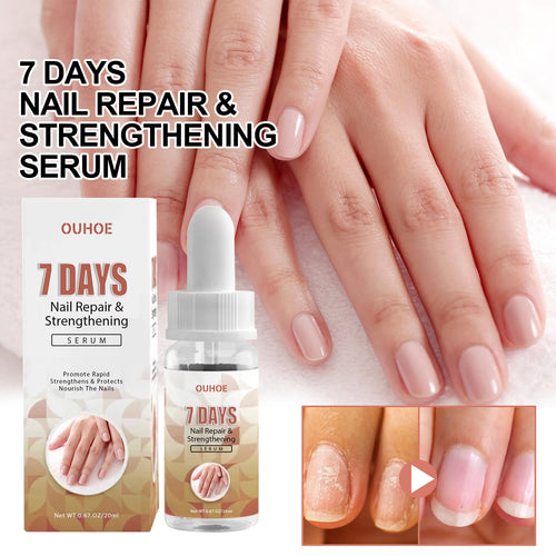 7 Day Nail Repair Essence Serum, Hand And Foot Nail Brightening Thickening Toenail Care Solution