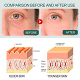 Brightening Collagen Facial Essence, Dark Spot Removal, Anti-Aging and Moisturizing