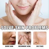Lavender Oil Control Acne-Cleansing Soap For Cleansing Facial Skin Pores Oil Control Acne-Moisturizing Cleansing Soap