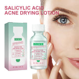 Salicylic Acid Acne Drying Serum, Gentle Repair Acne Skin Moisturizing Oil
