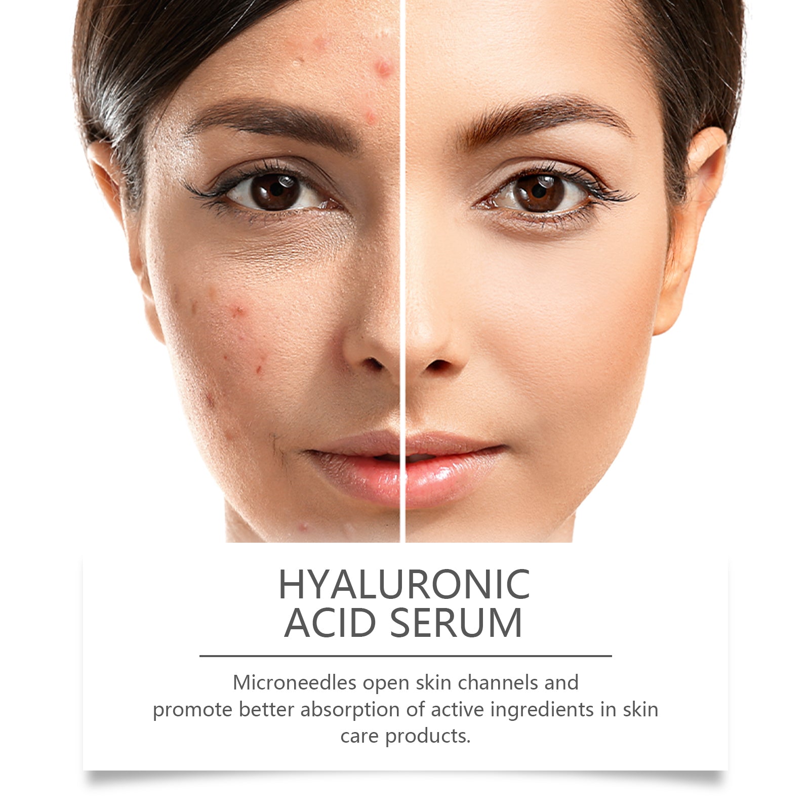 Hyaluronic Acid Face Serum with Roller, Radiant Skin Improves Skin Pores And Hydrates