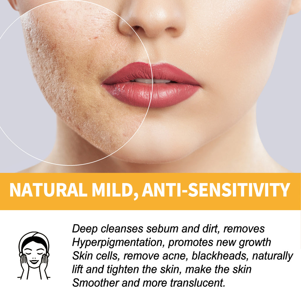 Honey Peel Mask, Tightens Pores Brightens Skin And Gently Removes Blackheads Apply Facial Mask
