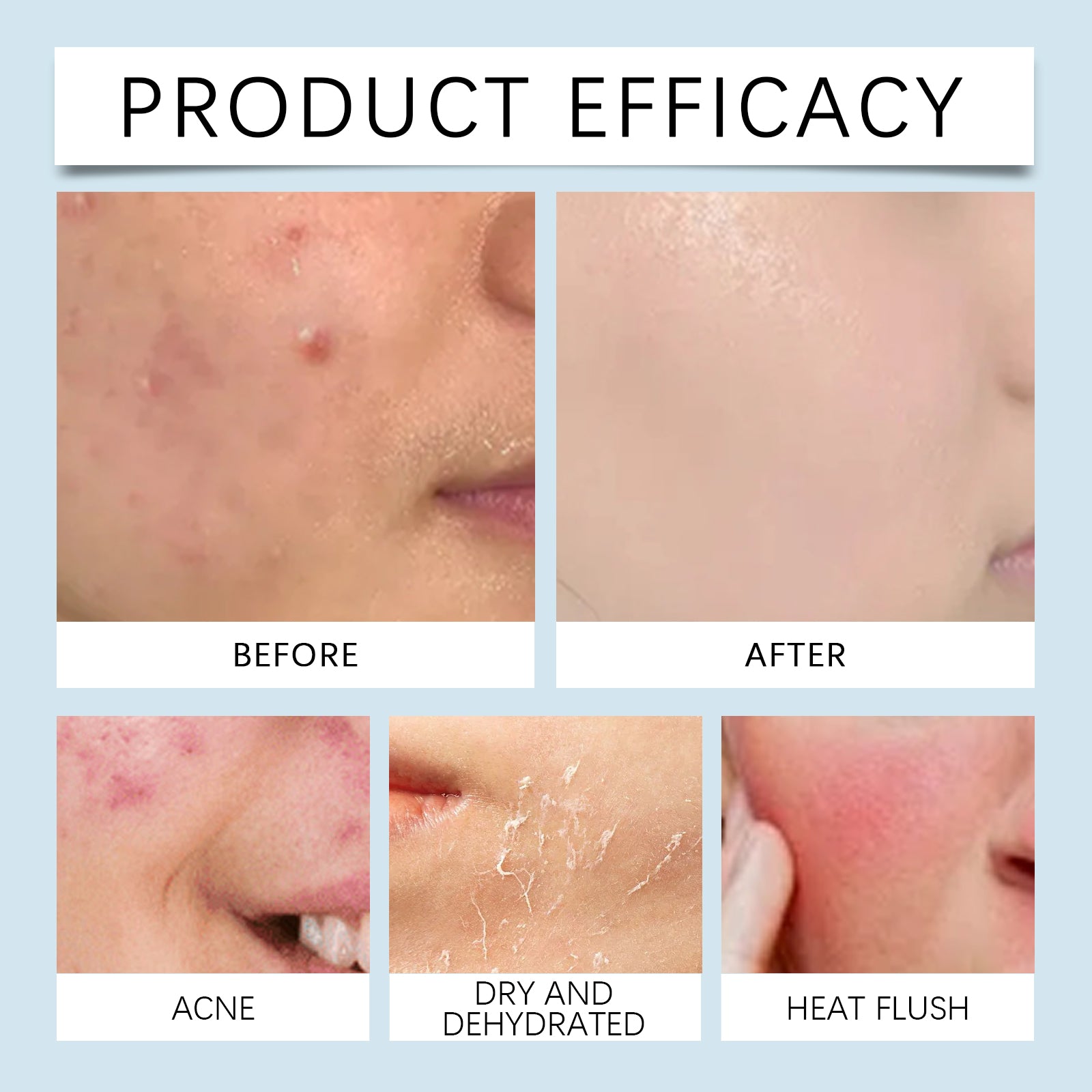 Hyaluronic Acid Face Serum with Roller, Radiant Skin Improves Skin Pores And Hydrates