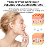 Collagen Membrane Patch Kit, Reduces Wrinkles, Smooths Forehead Fine Lines, Moisturizes And Tightens Skin Protein Membrane